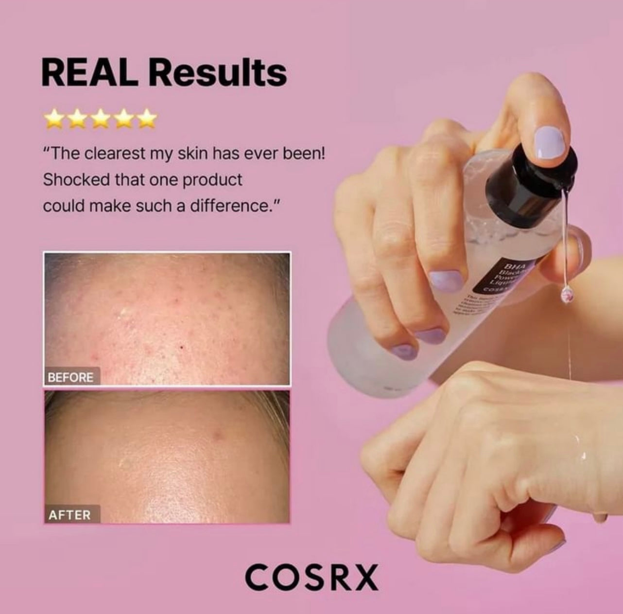 COSRX BHA Blackhead Power Liquid 100ml